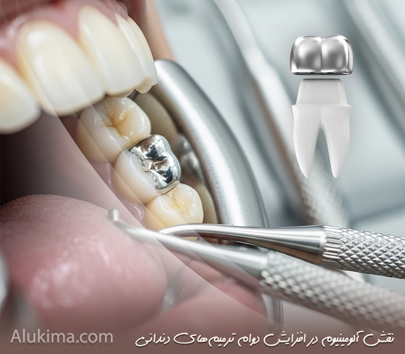 کاربرد آلومینیوم در دندان‌پزشکی و پرکردگی آمالگام